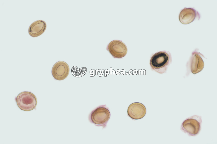 Taenia saginata - oeufs isolés de déjections animales x100 - gryphea.com